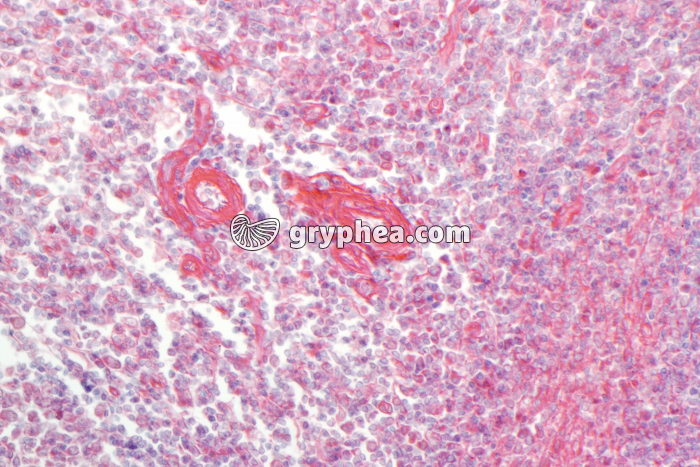 Thymus jeune x100 - gryphea.org